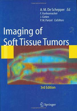 Imaging of Soft Tissue Tumors pdf epub mobi 电子书 下载