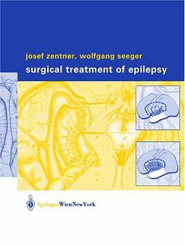 Surgical Treatment of Epilepsy pdf epub mobi 电子书 下载