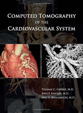 Computed Tomography of the Cardiovascular System pdf epub mobi 电子书 下载