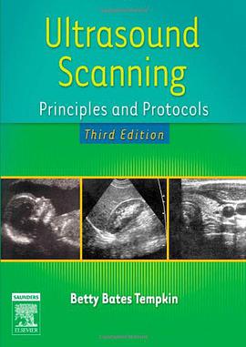 Ultrasound Scanning pdf epub mobi 电子书 下载