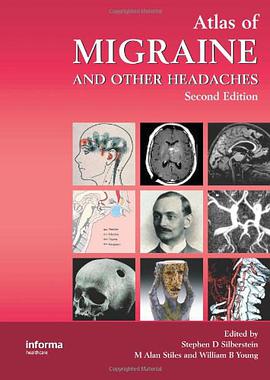 Atlas of Migraine and Other Headaches pdf epub mobi 电子书 下载
