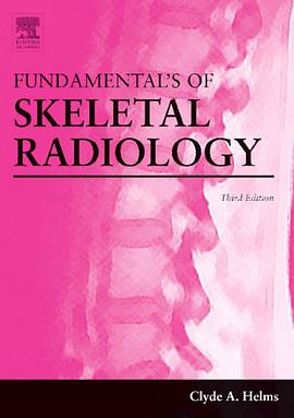 Fundamentals of Skeletal Radiology pdf epub mobi 电子书 下载