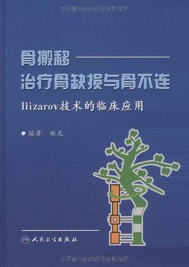 骨搬移治疗骨缺损与骨不连-Ilizarov技术的临床应用 pdf epub mobi 电子书 下载