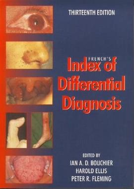 French's Index of Differential Diagnosis pdf epub mobi 电子书 下载