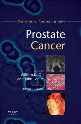 Prostate Cancer pdf epub mobi 電子書 下載