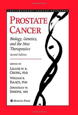 Prostate Cancer pdf epub mobi 电子书 下载