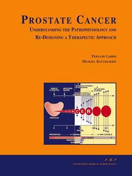 Prostate Cancer pdf epub mobi 电子书 下载