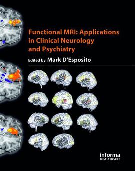 Functional MRI pdf epub mobi 电子书 下载