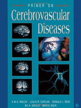 Primer on Cerebrovascular Diseases pdf epub mobi 电子书 下载