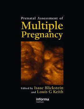 Prenatal Assessment of Multiple Pregnancy pdf epub mobi 电子书 下载