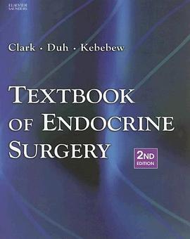 Textbook of Endocrine Surgery pdf epub mobi 电子书 下载