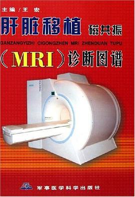 肝脏移植磁共振 pdf epub mobi 电子书 下载