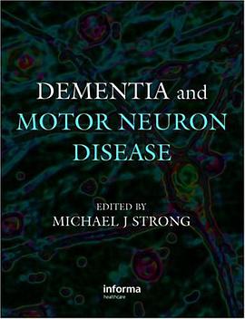 Dementia and Motor Neuron Disease pdf epub mobi 电子书 下载