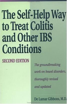Self Help Way To Treat Colitis and Other IBS Conditions, Second Edition pdf epub mobi 电子书 下载