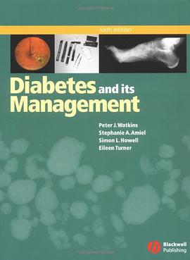 Diabetes and Its Management pdf epub mobi 电子书 下载