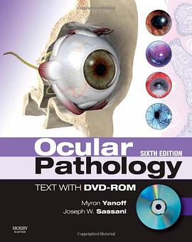 Ocular Pathology with DVD-ROM pdf epub mobi 电子书 下载