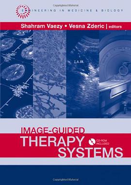 Image-Guided Therapy Systems pdf epub mobi 電子書 下載