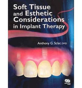 Soft Tissue and Esthetic Considerations in Implant Dentistry pdf epub mobi 電子書 下載