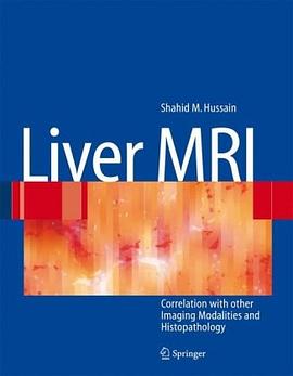 Liver MRI pdf epub mobi 電子書 下載