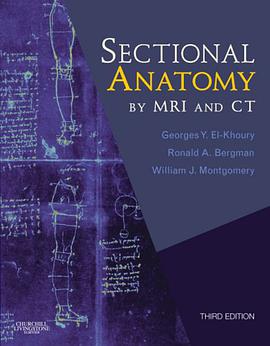 Sectional Anatomy by MRI and CT With Website pdf epub mobi 电子书 下载