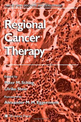Regional Cancer Therapy pdf epub mobi 电子书 下载