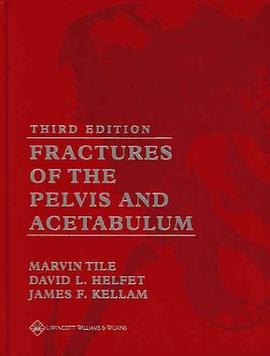 Fractures of the Pelvis and Acetabulum pdf epub mobi 电子书 下载