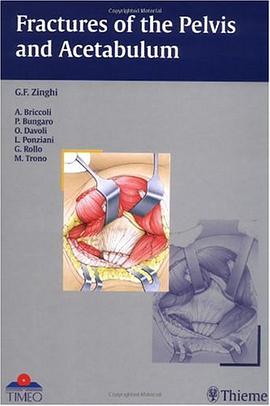 Fractures of the Pelvis and Acetabulum pdf epub mobi 电子书 下载