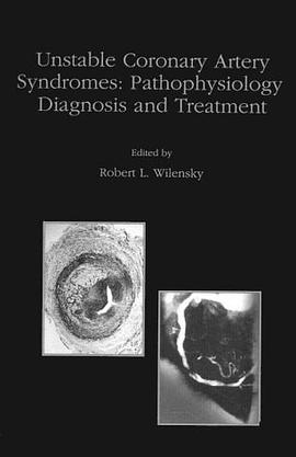 Unstable Coronary Artery Syndromes pdf epub mobi 电子书 下载