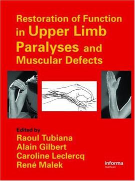 Restoration of Function in Upper Limb Paralyses and Muscular Defects pdf epub mobi 电子书 下载