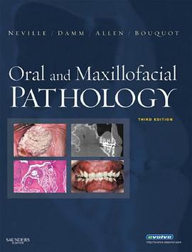 Oral and Maxillofacial Pathology pdf epub mobi 电子书 下载