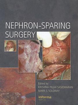 Nephron-Sparing Surgery pdf epub mobi 电子书 下载