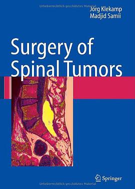 Surgery of Spinal Tumors pdf epub mobi 電子書 下載