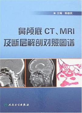 鼻颅底CT、MRI及底断层解剖对照图谱 pdf epub mobi 电子书 下载