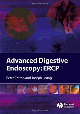 Advanced Digestive Endoscopy pdf epub mobi 电子书 下载