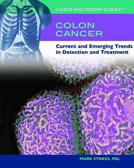 Colon Cancer pdf epub mobi 电子书 下载