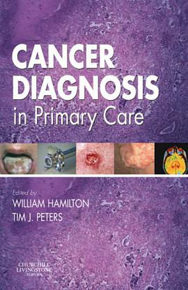 Cancer Diagnosis in Primary Care