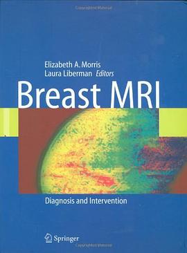 Breast MRI pdf epub mobi 電子書 下載