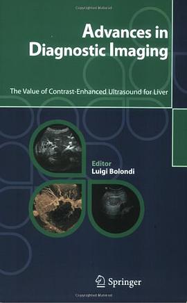 Advances in Diagnostic Imaging pdf epub mobi 电子书 下载