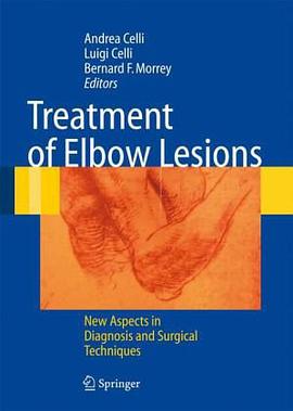 Treatment of Elbow Lesions pdf epub mobi 电子书 下载