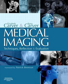 Medical Imaging pdf epub mobi 电子书 下载