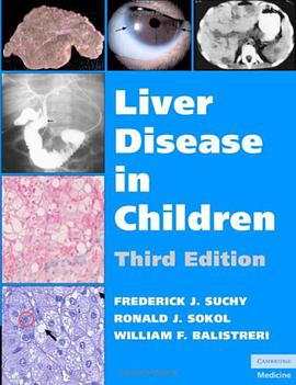 Liver Disease in Children pdf epub mobi 电子书 下载