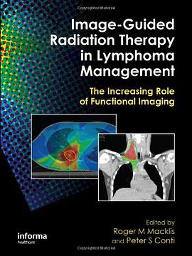 Image-guided Radiation Therapy in Lymphoma Management pdf epub mobi 电子书 下载