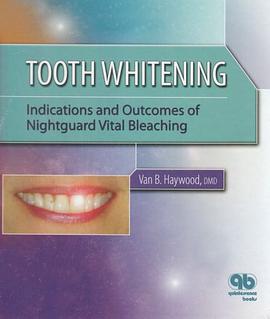 Tooth Whitening pdf epub mobi 電子書 下載