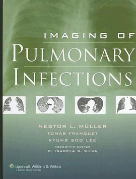 Imaging of Pulmonary Infections pdf epub mobi 电子书 下载
