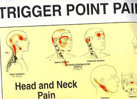 Trigger Points of Pain pdf epub mobi 电子书 下载
