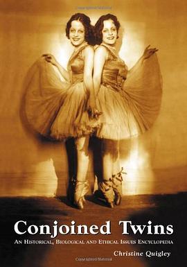 Conjoined Twins pdf epub mobi 电子书 下载