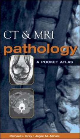 CT and MRI Pathology pdf epub mobi 电子书 下载