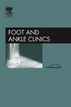 Post Traumatic Reconstruction of the Foot and Ankle, An Issue of Foot and Ankle Clinics (The Clinics pdf epub mobi 电子书 下载