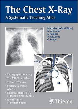 The Chest X-Ray pdf epub mobi 电子书 下载