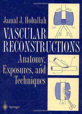 Vascular Reconstruction pdf epub mobi 电子书 下载